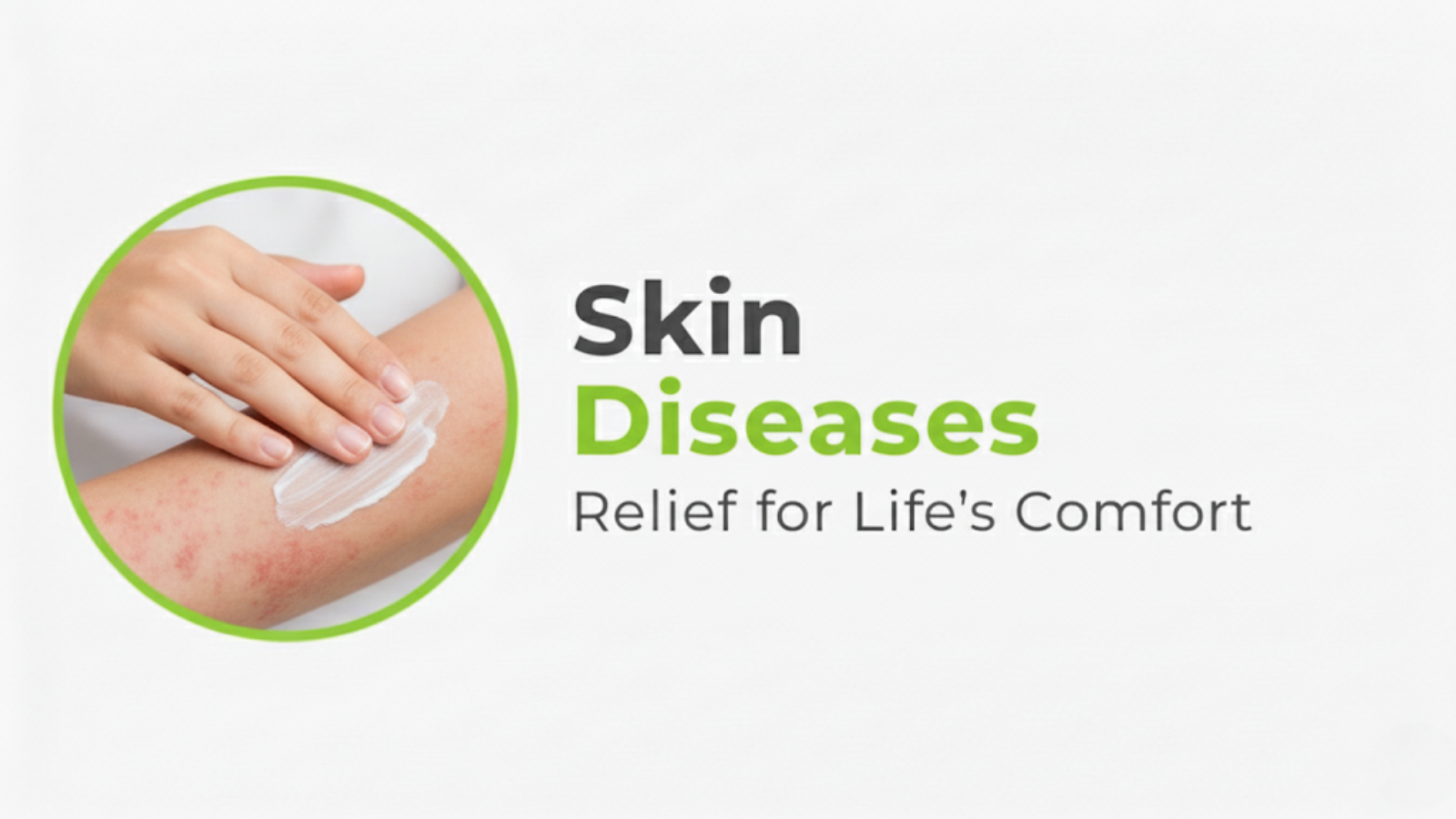 Skin Diseases